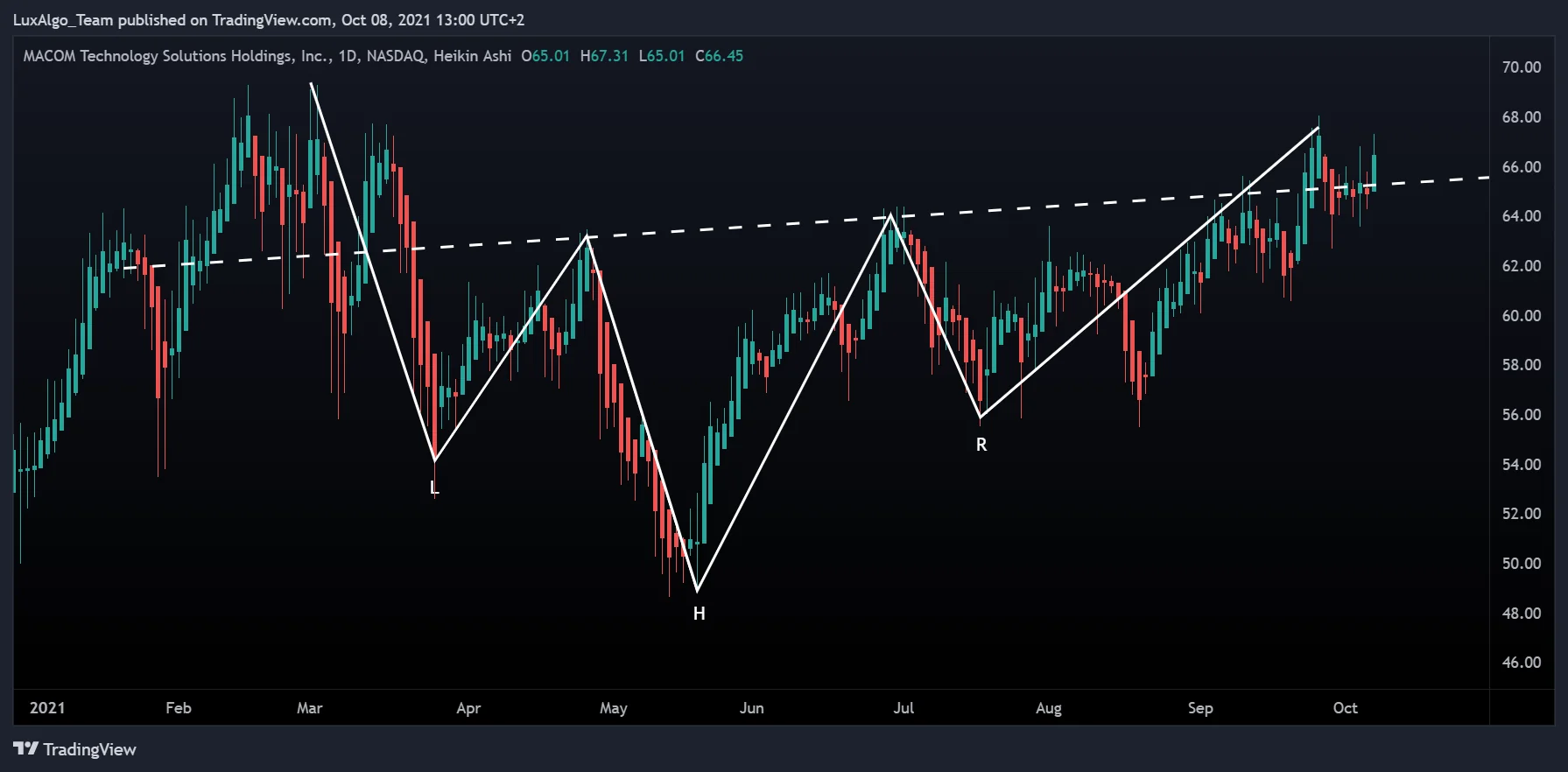 Historical MTSI daily Heikin Ashi chart with an inverse head and shoulders drawing